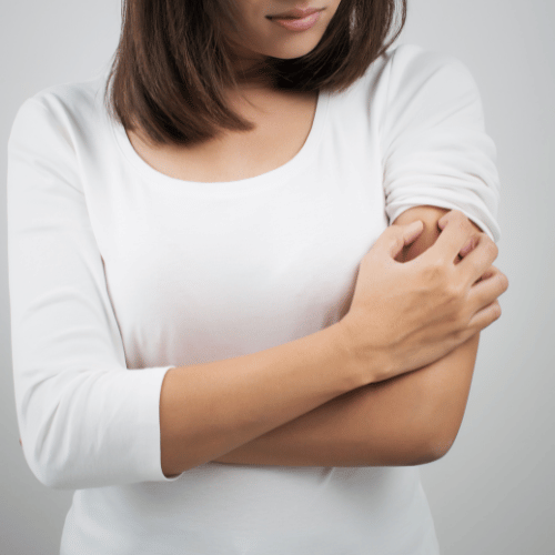 Contactdermatitis & huidreacties door producten