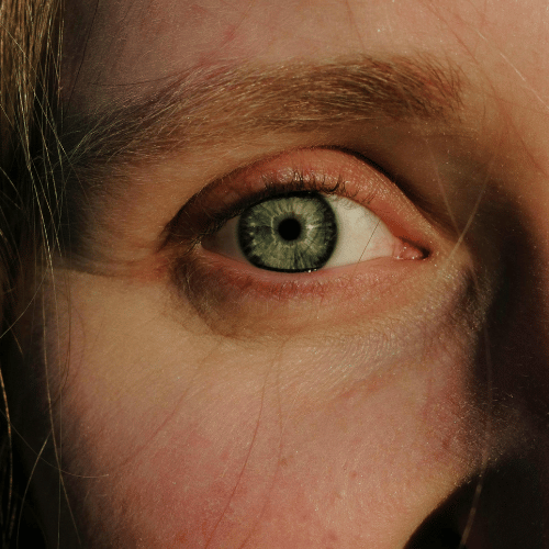 Droge huid rond ogen en geïrriteerde oogcontour: zo herstel je rust en comfort