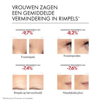 Vichy Liftactiv Retinol Specialist A+ Serum 30ml