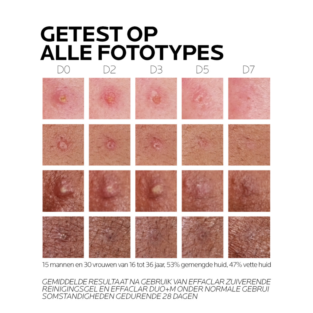 La Roche-Posay Effaclar Duo+M Dagcrème 40ml