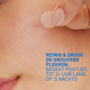 CeraVe Anti-Puistjes Patches 22 stuks