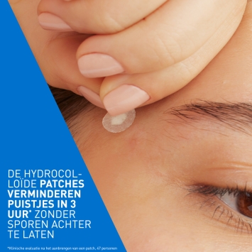 CeraVe Anti-Puistjes Patches 22 stuks