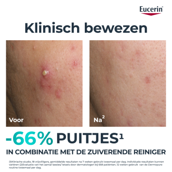 Eucerin DermoPure Triple Action Serum 40ml