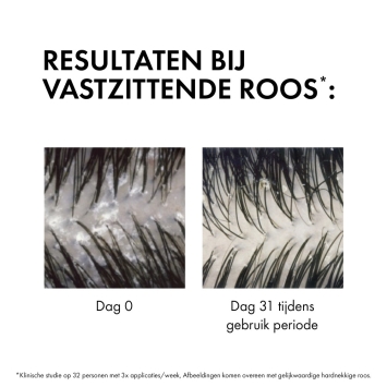 Vichy Dercos Anti-Roos DS Shampoo Normaal - Vet Haar Navulling 390ml
